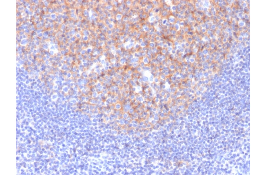 Immunohistochemistry - Anti-TAPA1 Antibody [1.3.3.22] (A250802) - Antibodies.com