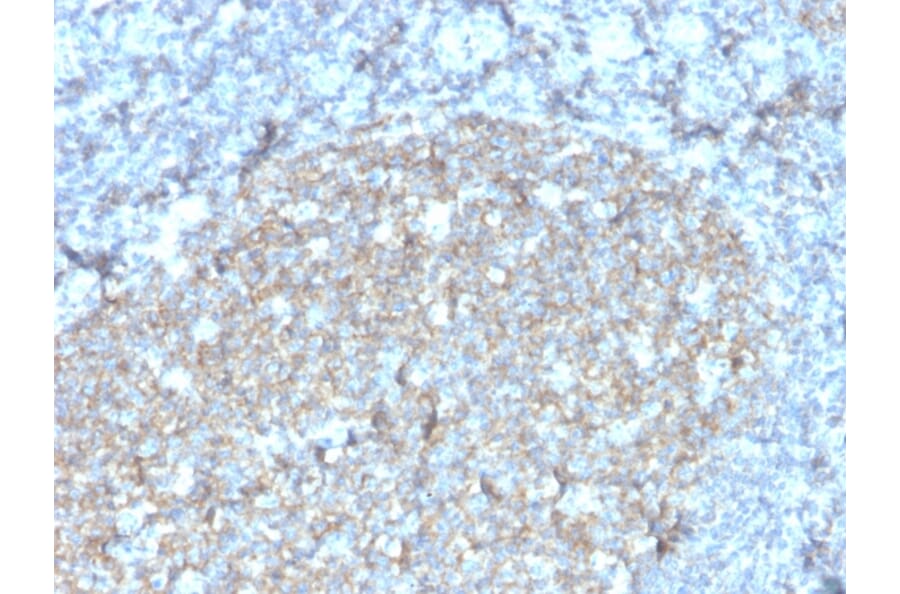 Immunohistochemistry - Anti-TAPA1 Antibody [r1.3.3.22] (A250802) - Antibodies.com