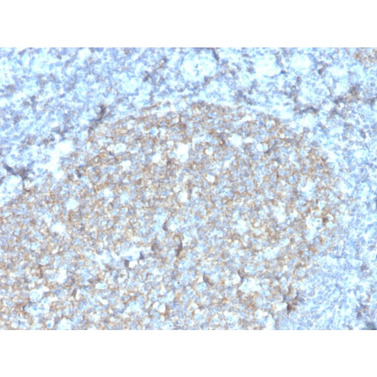 Immunohistochemistry - Anti-TAPA1 Antibody [r1.3.3.22] (A250802) - Antibodies.com