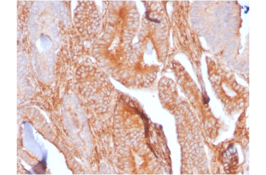 Immunohistochemistry - Anti-TAPA1 Antibody [C81/2885R] (A250803) - Antibodies.com