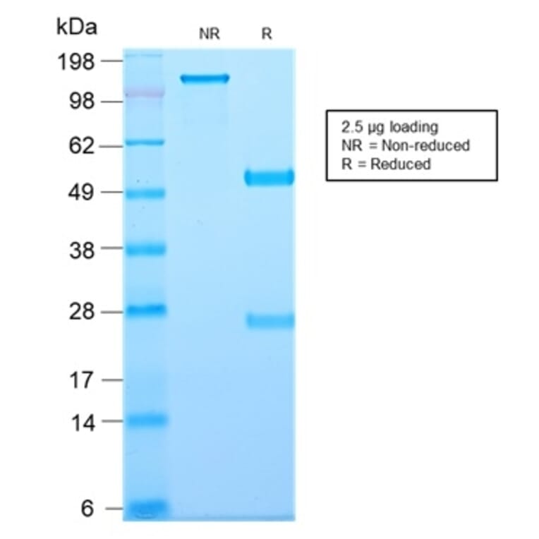 SDS-PAGE - Anti-TAPA1 Antibody [C81/2885R] (A250804) - Antibodies.com