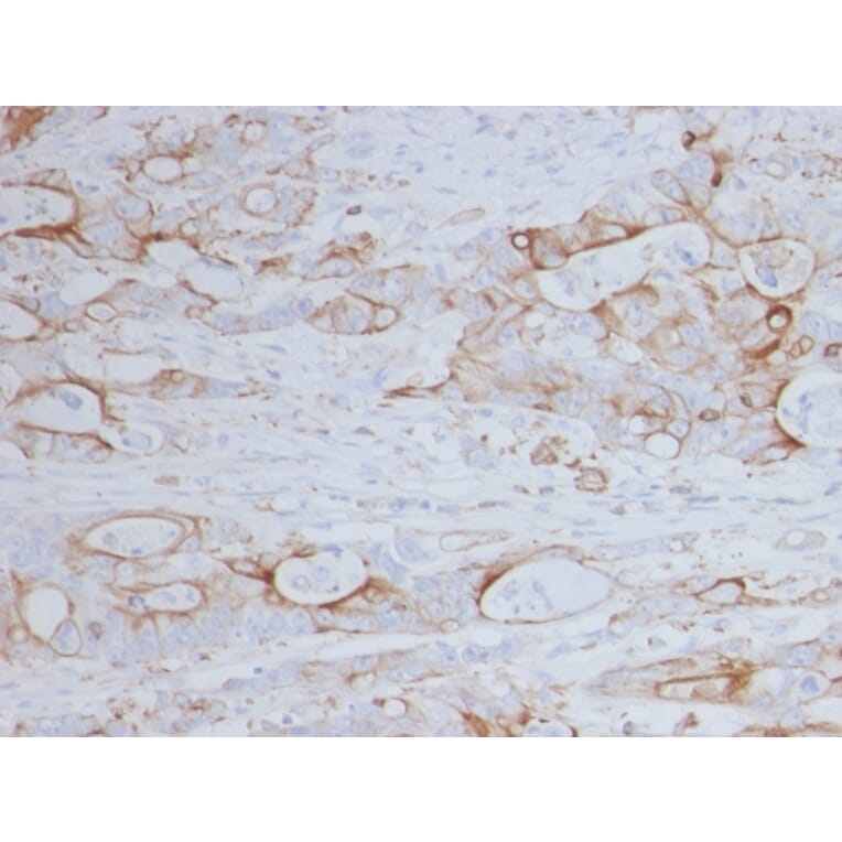 Immunohistochemistry - Anti-CD151 Antibody [11G5a] (A250804) - Antibodies.com
