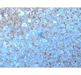 Immunohistochemistry - Anti-CDK1 Antibody [POH-1] (A250805) - Antibodies.com