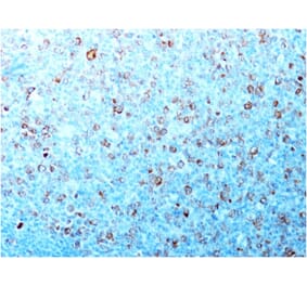 Immunohistochemistry - Anti-CDK1 Antibody [CDK1/873] (A250806) - Antibodies.com