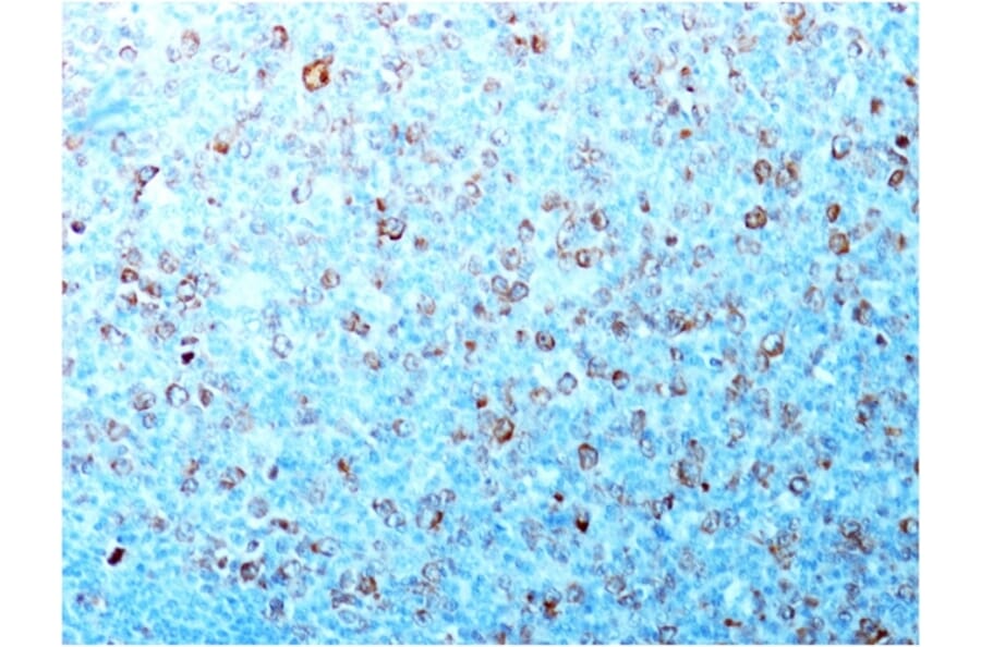 Immunohistochemistry - Anti-CDK1 Antibody [CDK1/873] (A250806) - Antibodies.com
