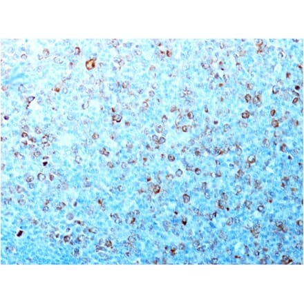 Immunohistochemistry - Anti-CDK1 Antibody [CDK1/873] (A250806) - Antibodies.com