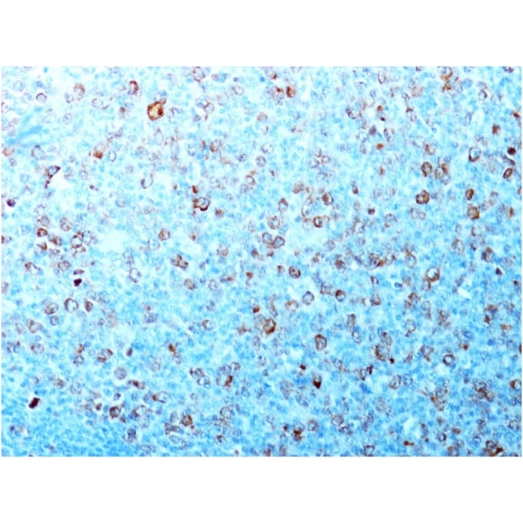 Immunohistochemistry - Anti-CDK1 Antibody [CDK1/873] (A250806) - Antibodies.com