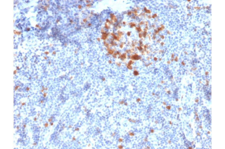 Immunohistochemistry - Anti-CDK1 Antibody [A17.1.1] (A250807) - Antibodies.com