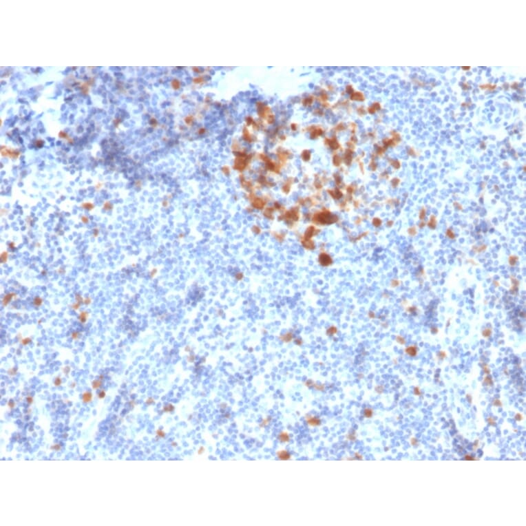 Immunohistochemistry - Anti-CDK1 Antibody [A17.1.1] (A250807) - Antibodies.com