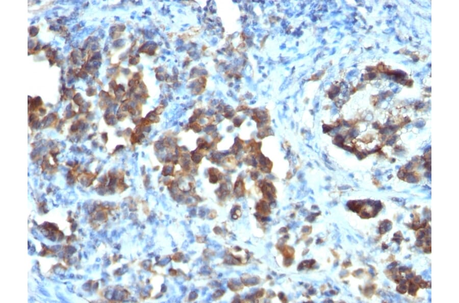 Immunohistochemistry - Anti-CDC20 Antibody [CDC20/1102] (A250811) - Antibodies.com