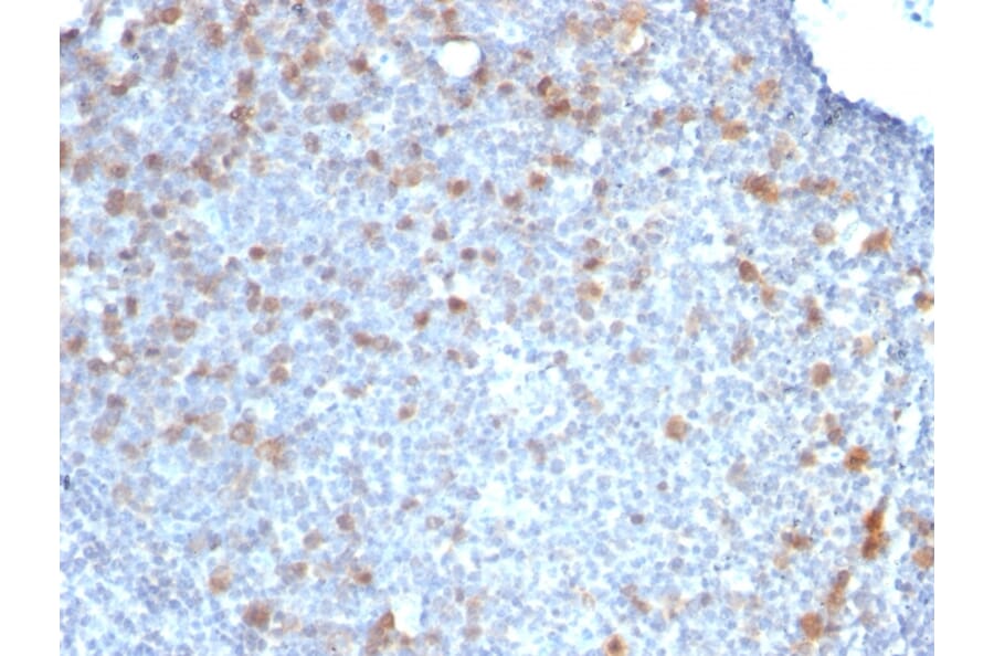 Immunohistochemistry - Anti-CDC20 Antibody [CDC20/1102] (A250812) - Antibodies.com