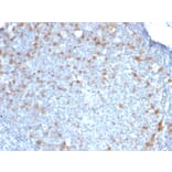 Immunohistochemistry - Anti-CDC20 Antibody [CDC20/1102] (A250812) - Antibodies.com