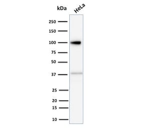 Western Blot - Anti-Major Vault Protein Antibody [1014] (A250814) - Antibodies.com