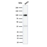 Western Blot - Anti-Major Vault Protein Antibody [1014] (A250814) - Antibodies.com