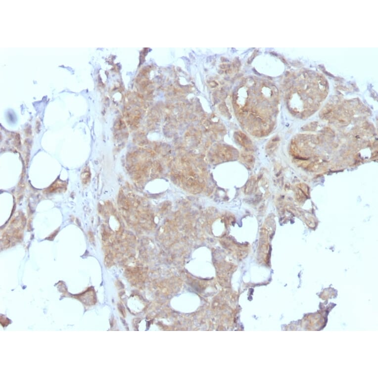 Immunohistochemistry - Anti-Major Vault Protein Antibody [1032] (A250814) - Antibodies.com