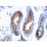 Immunohistochemistry - Anti-Major Vault Protein Antibody [SPM280] (A250815) - Antibodies.com