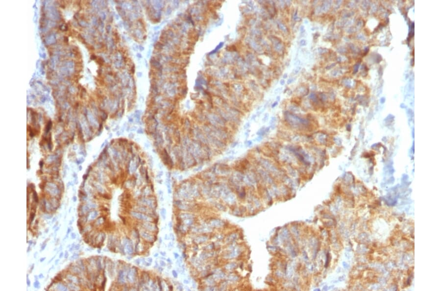Immunohistochemistry - Anti-TNFS15 Antibody [VEGI/1283] (A250817) - Antibodies.com