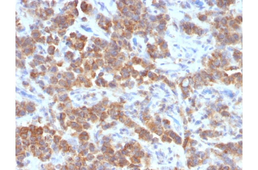 Immunohistochemistry - Anti-TNFS15 Antibody [VEGI/1283] (A250818) - Antibodies.com