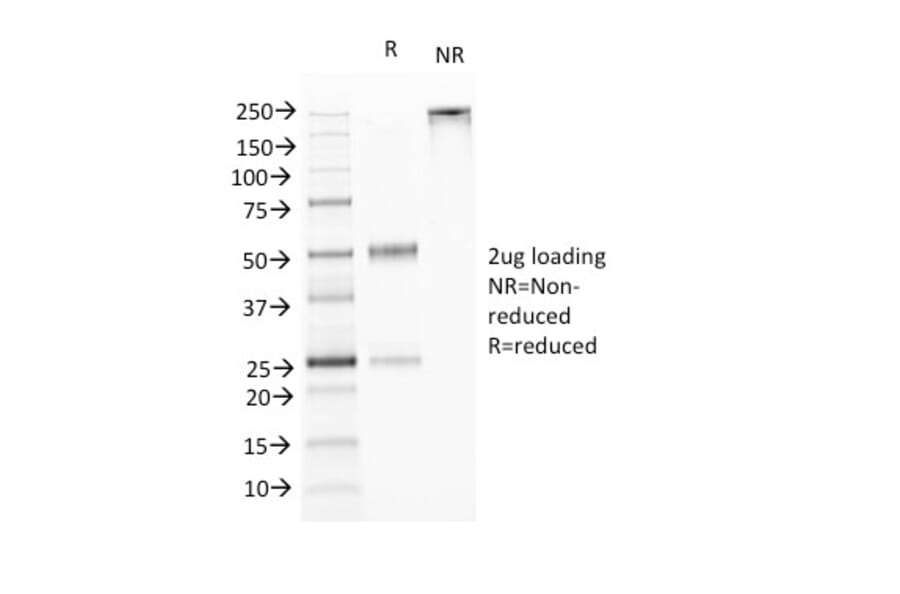 SDS-PAGE - Anti-TNFS15 Antibody [VEGI/1283] (A250818) - Antibodies.com