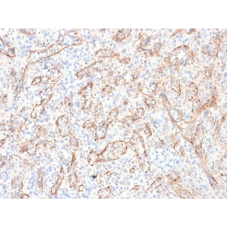 Immunohistochemistry - Anti-TNFS15 Antibody [rVEGI/1283] (A253576) - Antibodies.com