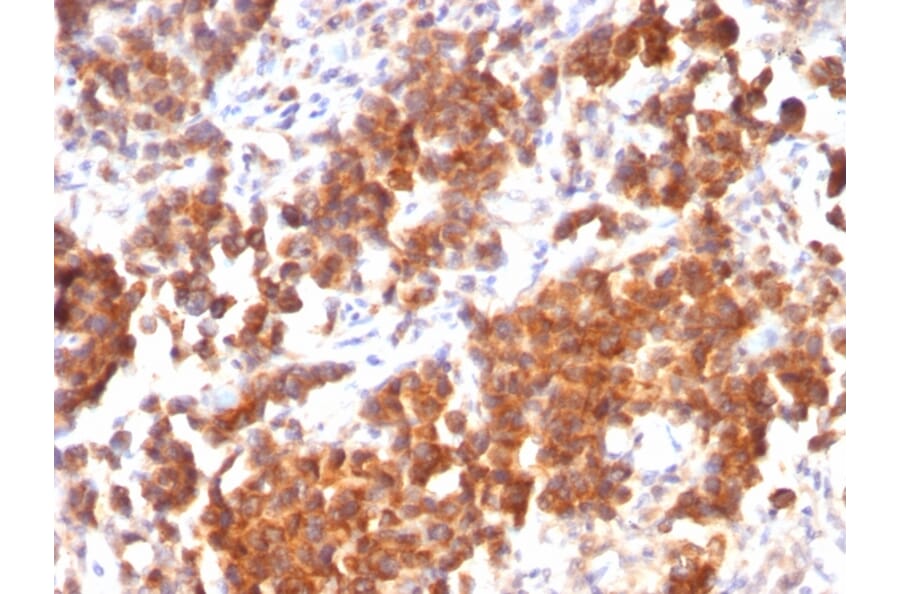 Immunohistochemistry - Anti-TNFS15 Antibody [rVEGI/1283] (A252951) - Antibodies.com