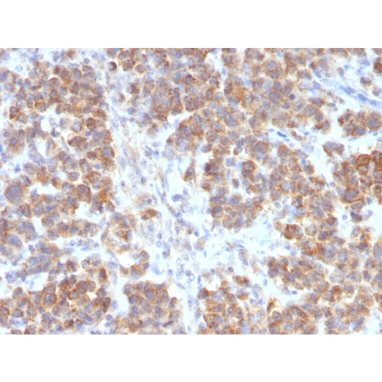 Immunohistochemistry - Anti-TNFS15 Antibody [VEGI/2052R] (A250820) - Antibodies.com