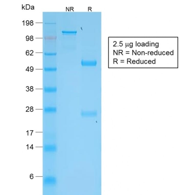 SDS-PAGE - Anti-TNFS15 Antibody [VEGI/2052R] (A250820) - Antibodies.com