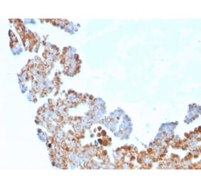 Immunohistochemistry - Anti-CDC34 Antibody [CPTC-CDC34-2] (A250821) - Antibodies.com