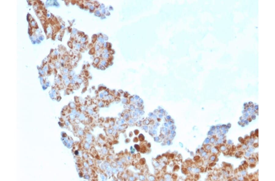 Immunohistochemistry - Anti-CDC34 Antibody [CPTC-CDC34-2] (A250821) - Antibodies.com