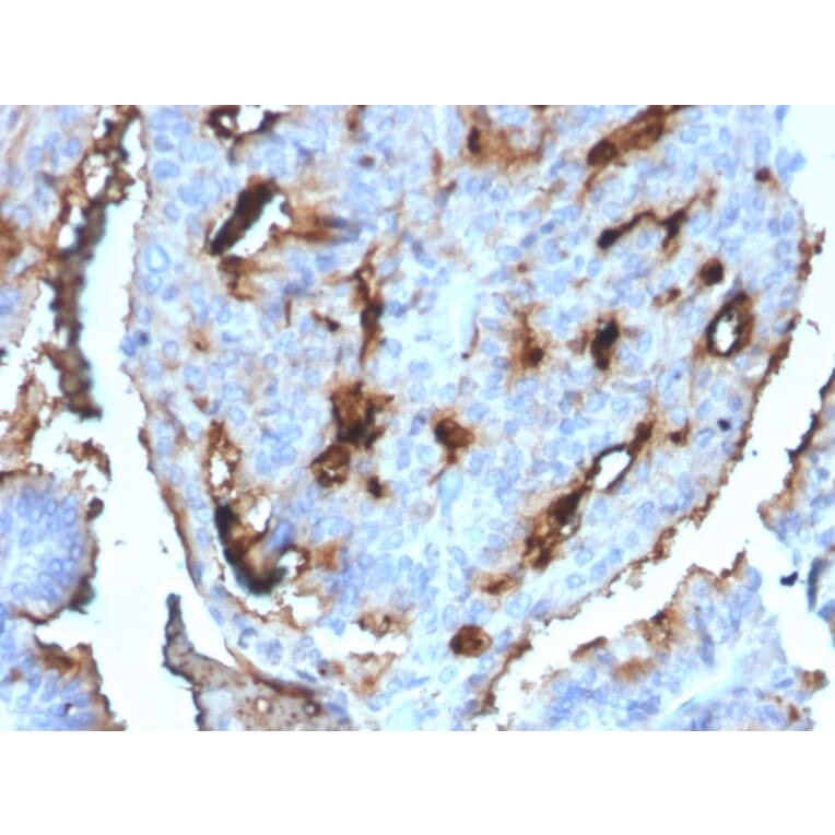 Immunohistochemistry - Anti-CDC34 Antibody [CPTC-CDC34-2] (A250821) - Antibodies.com