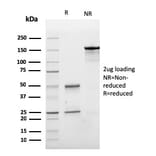 SDS-PAGE - Anti-E Cadherin Antibody [CDH1/3256] (A250822) - Antibodies.com