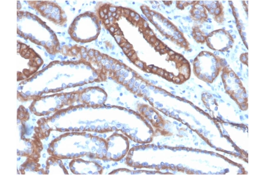 Immunohistochemistry - Anti-E Cadherin Antibody [CDH1/4585] (A250823) - Antibodies.com