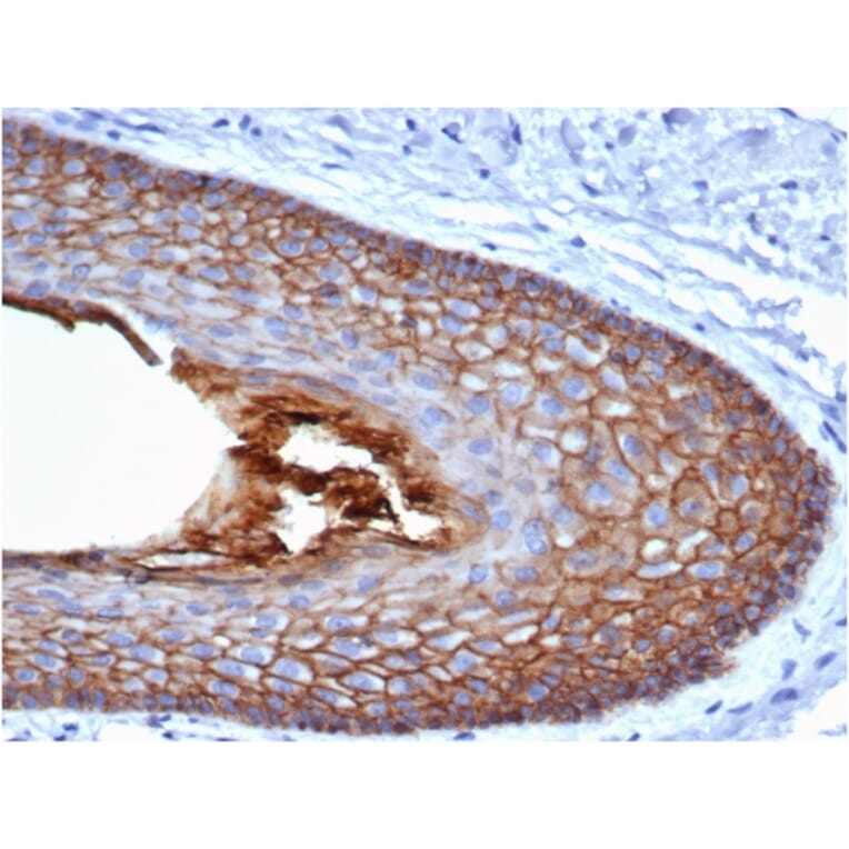 Immunohistochemistry - Anti-E Cadherin Antibody [CDH1/4585] (A250823) - Antibodies.com
