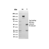 SDS-PAGE - Anti-E Cadherin Antibody [CDH1/4585] (A250823) - Antibodies.com