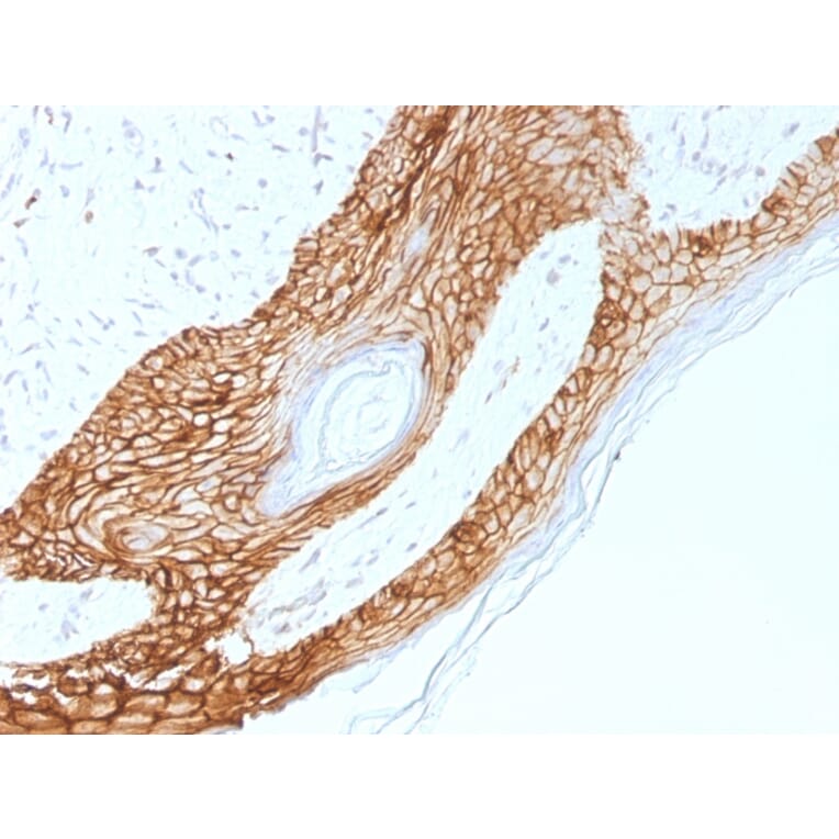 Immunohistochemistry - Anti-E Cadherin Antibody [4A2] (A250824) - Antibodies.com