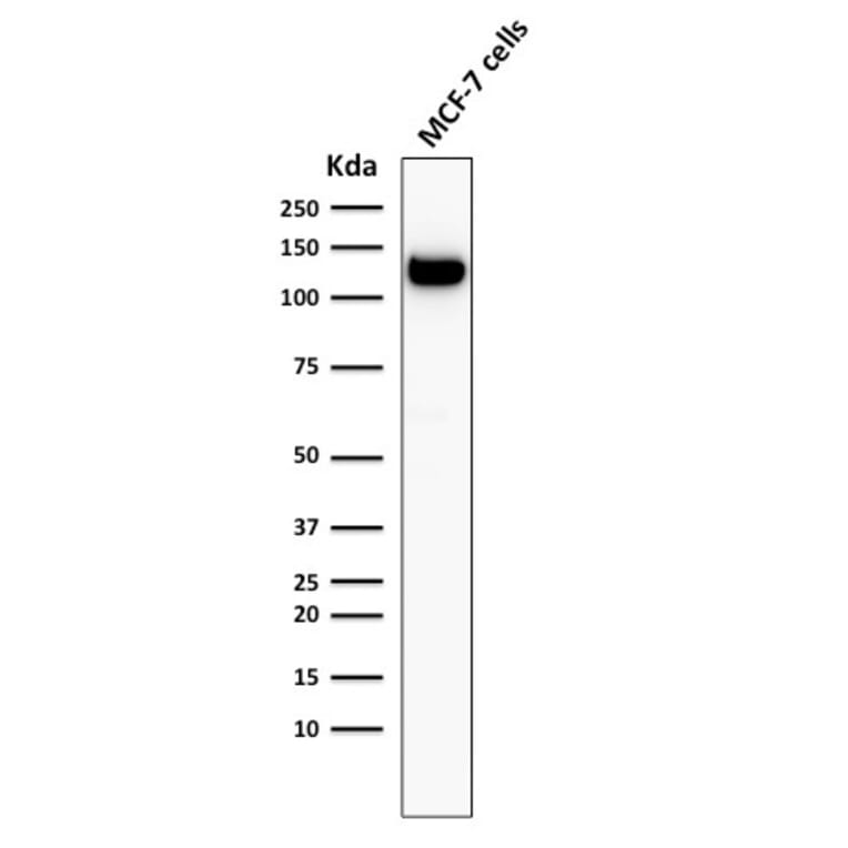 Western Blot - Anti-E Cadherin Antibody [4A2] (A250824) - Antibodies.com