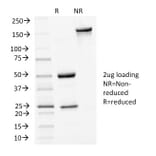 SDS-PAGE - Anti-E Cadherin Antibody [4A2] (A250824) - Antibodies.com