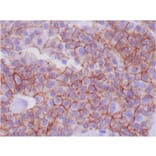 Immunohistochemistry - Anti-E Cadherin Antibody [CDH1/1525] (A250825) - Antibodies.com