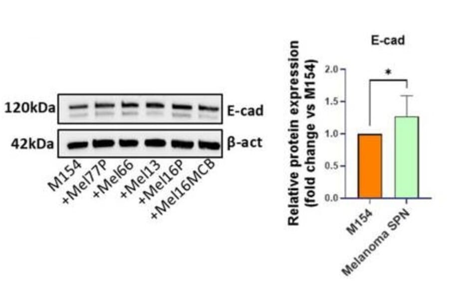 Western Blot - Anti-E Cadherin Antibody [CDH1/1525] - Antibodies.com