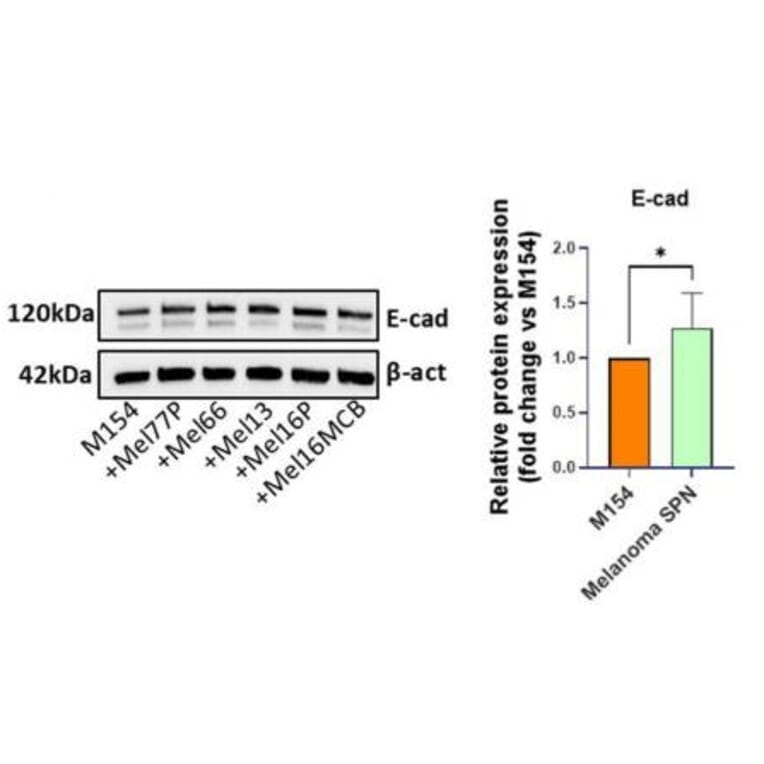 Western Blot - Anti-E Cadherin Antibody [CDH1/1525] - Antibodies.com