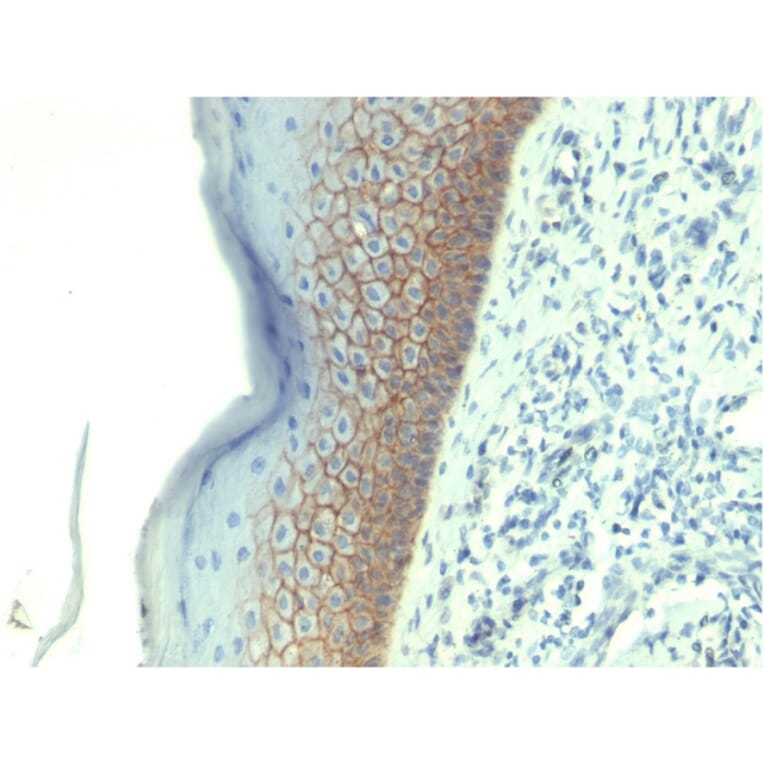 Immunohistochemistry - Anti-E Cadherin Antibody [CDH1/1525] (A250825) - Antibodies.com