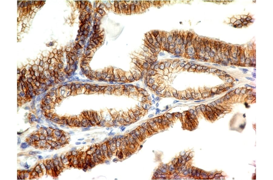 Immunohistochemistry - Anti-E Cadherin Antibody [CDH1/1525] (A250825) - Antibodies.com