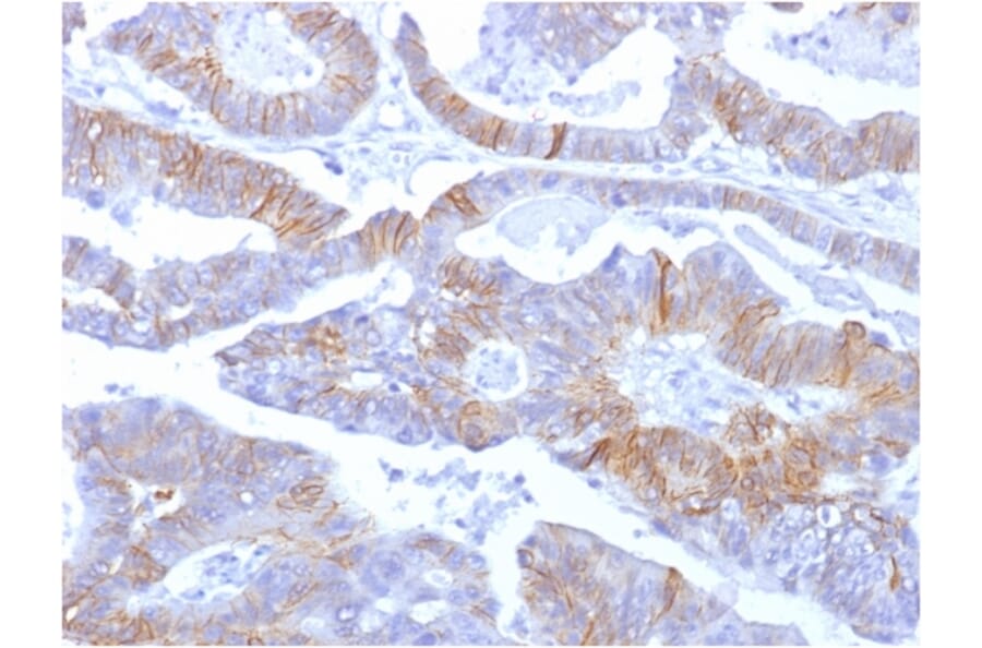 Immunohistochemistry - Anti-E Cadherin Antibody [SPM381] (A250826) - Antibodies.com