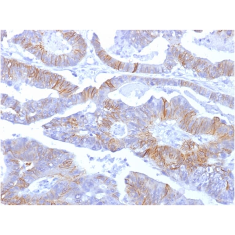 Immunohistochemistry - Anti-E Cadherin Antibody [SPM381] (A250826) - Antibodies.com