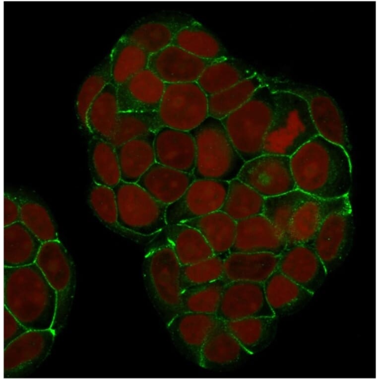 Immunofluorescence - Anti-E Cadherin Antibody [SPM381] (A250825) - Antibodies.com