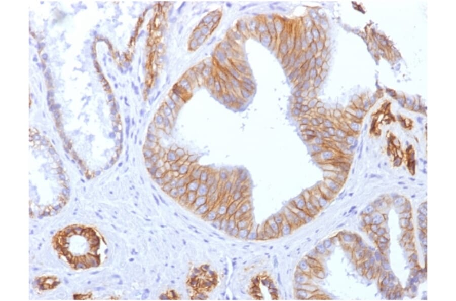 Immunohistochemistry - Anti-E Cadherin Antibody [SPM471] (A250827) - Antibodies.com