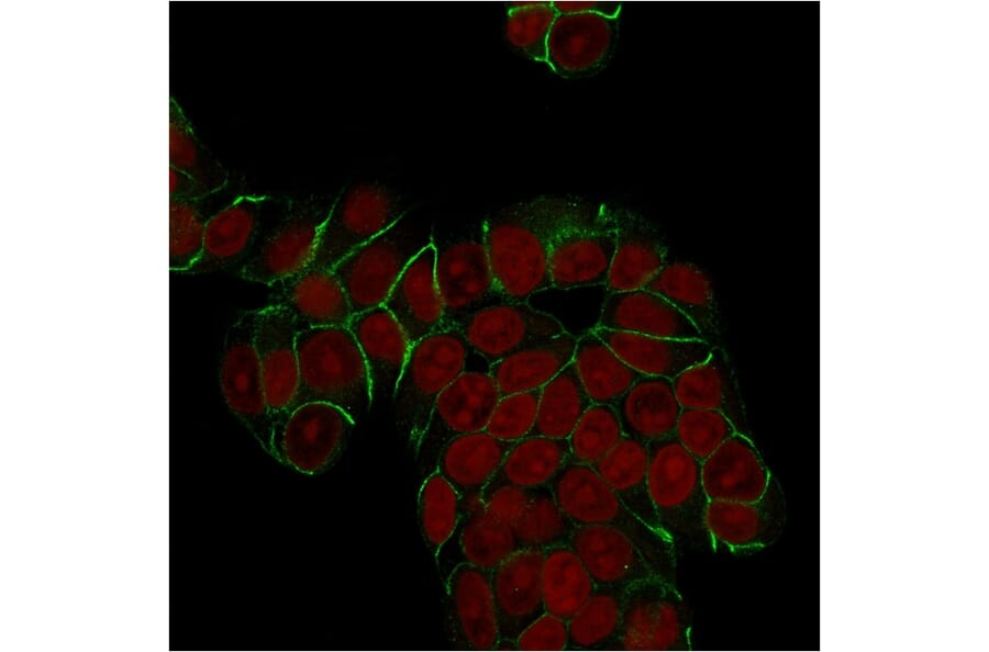 Immunofluorescence - Anti-E Cadherin Antibody [SPM471] (A250826) - Antibodies.com