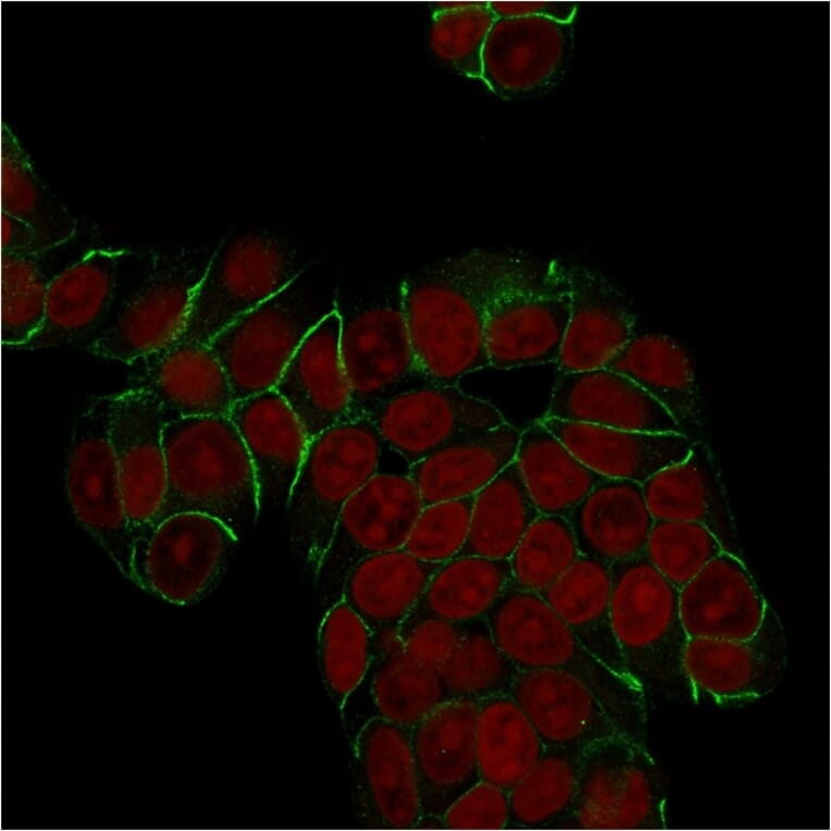 Immunofluorescence - Anti-E Cadherin Antibody [SPM471] (A250826) - Antibodies.com