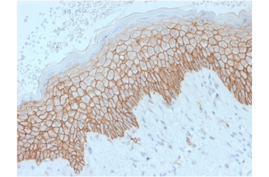 Immunohistochemistry - Anti-E Cadherin Antibody [SPM471] (A250827) - Antibodies.com