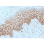 Immunohistochemistry - Anti-E Cadherin Antibody [SPM471] (A250827) - Antibodies.com
